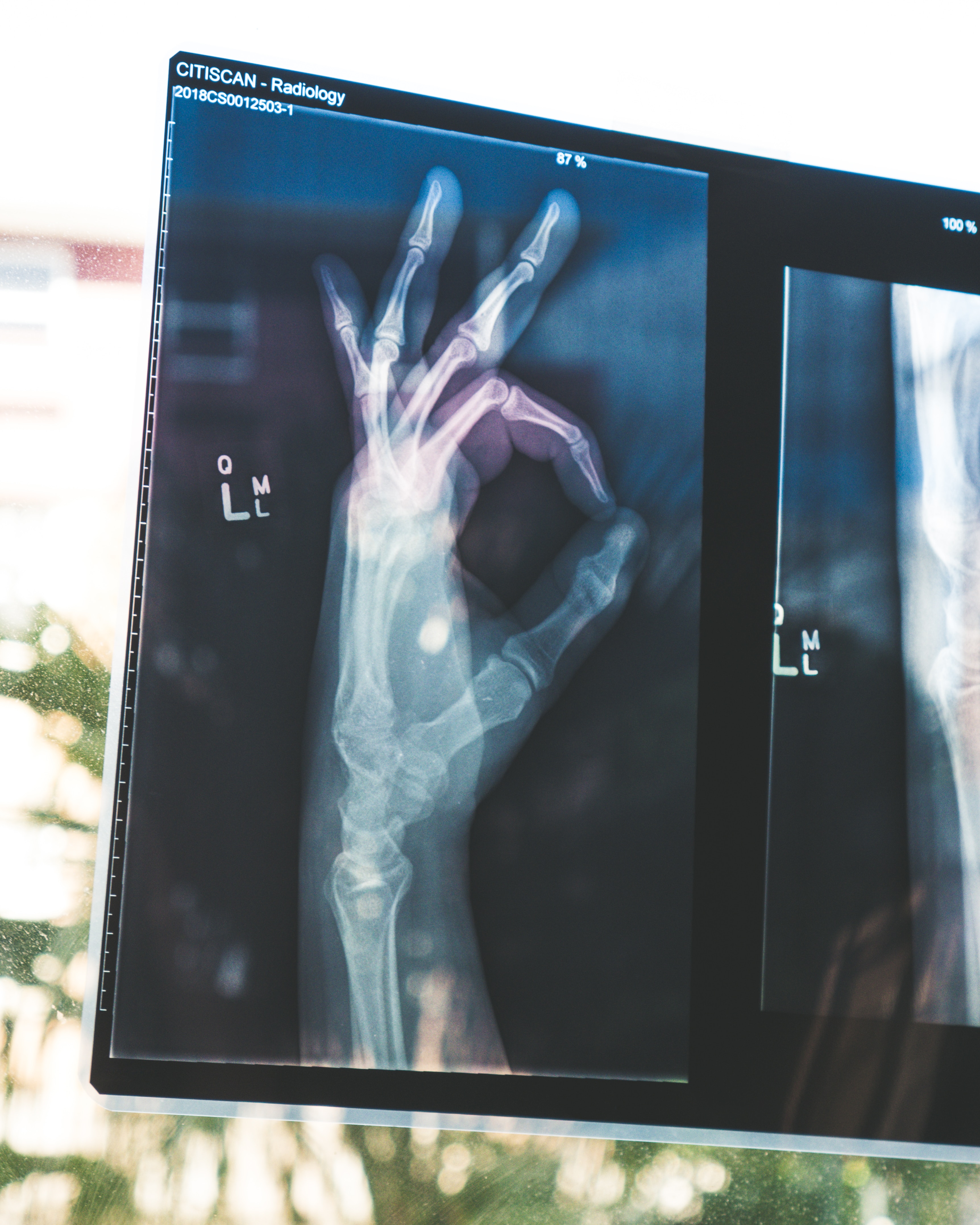 xray